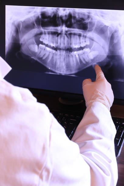 Best Emergency Dentist for Knocked-Out Tooth in Kyle, TX