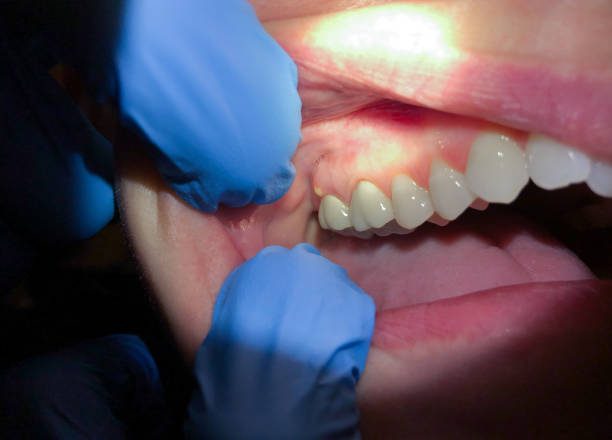 Best Mobile Emergency Dentist in Kyle, TX