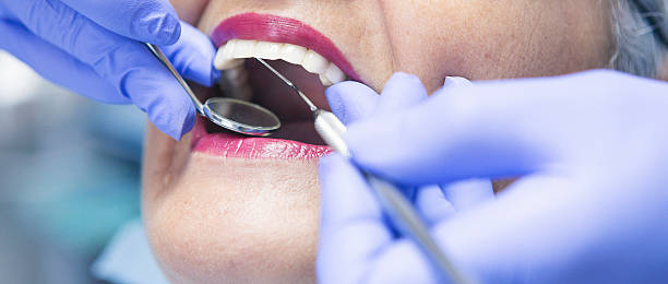 Best Emergency Root Canal Treatment in Kyle, TX